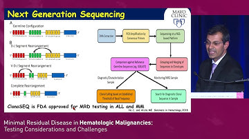 Game-Changing Potential of MRD in Hematological Malignancies: Overview and Importance