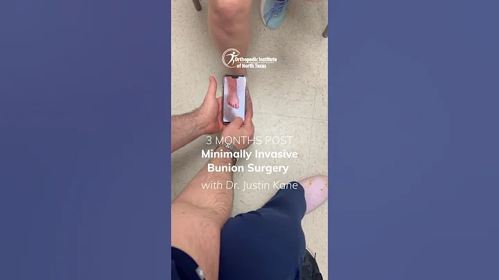 3 Months After Minimally Invasive Bunion Surgery | Dr. Justin Kane, OINT #bunions