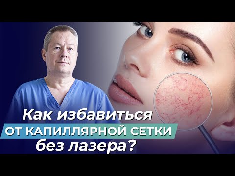 Как избавиться от сеточки на ногах в домашних условиях