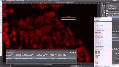 Setting scales and making scale bars for microscopy images