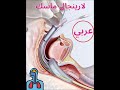 laryngeal mask airway Arabic  (القناع الحنجري)