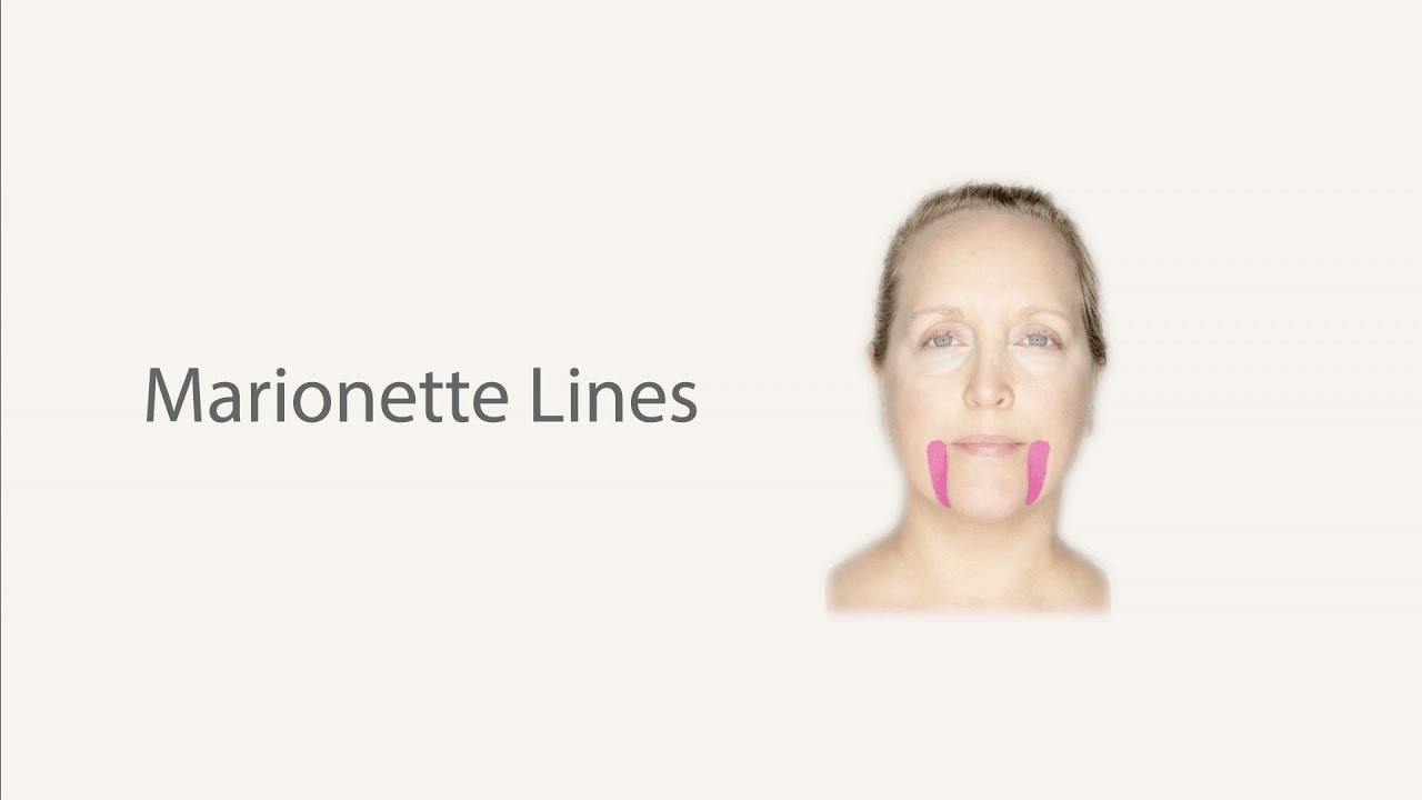 Help to reduce those [Puppet] Lines with Face Taping YouTube