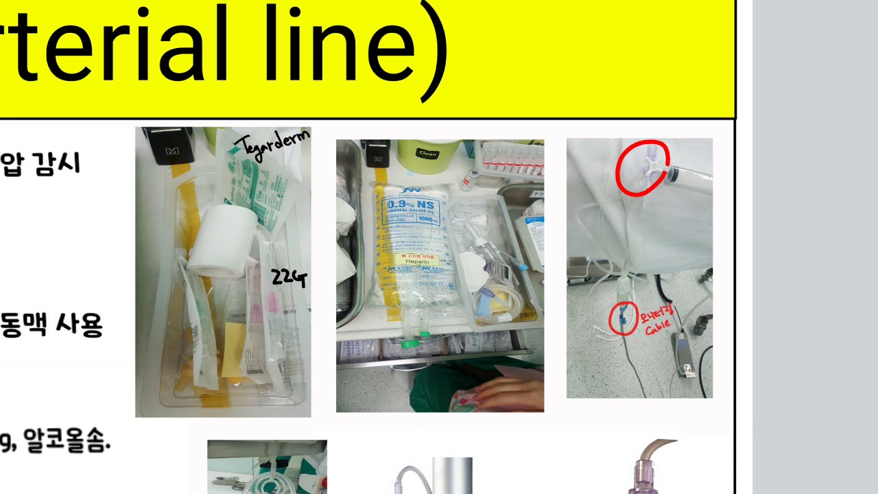 Arterial line \u0026 Central line