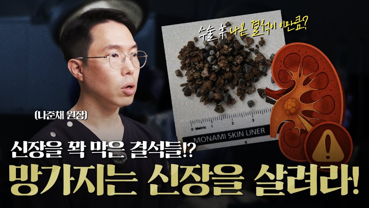 신장을 꽉막은 결석들! 망가지는 신장을 살려라(신장결석 치료 사례 2편) - YouTube