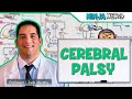 Cerebral Palsy: Etiology, Pathophysiology, Complications, Treatment