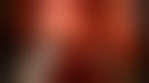 da Vinci Partial Nephrectomy Fluorescence Assisted Selective Arterial Clamping