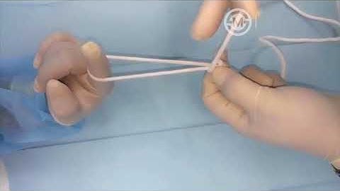 Simple and Safe Extracorporeal Knotting Technique for Laparoscopic Appendectomy