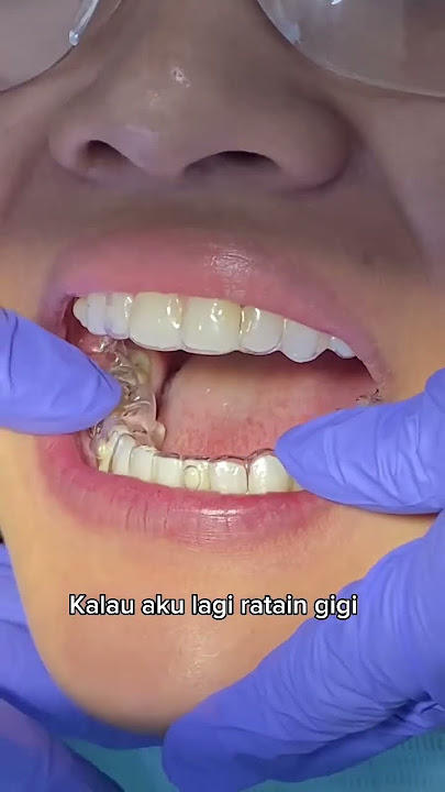 Rahasia ratain gigi tanpa ketauan?😱