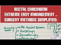 RECTAL CANCER | extreme easy management | MEDICINE with DR SHAMAMA.