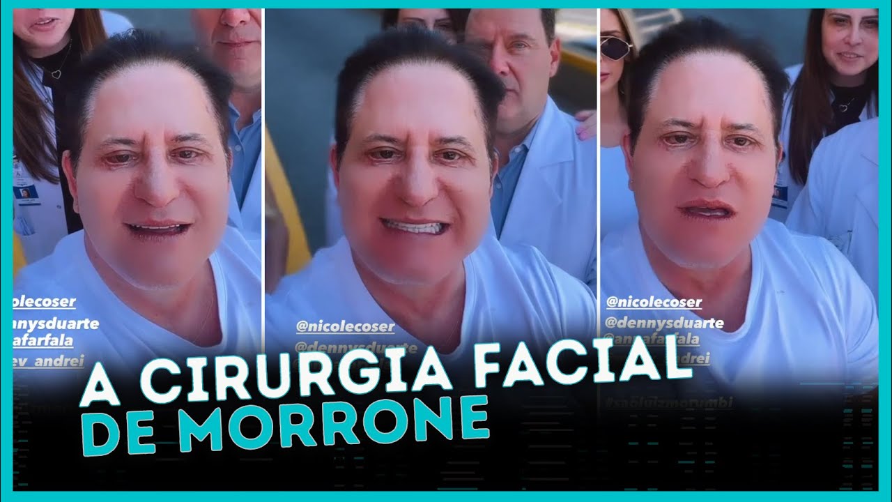 Marrone vira piada ao mostrar resultado de cirurgia facial; vídeo