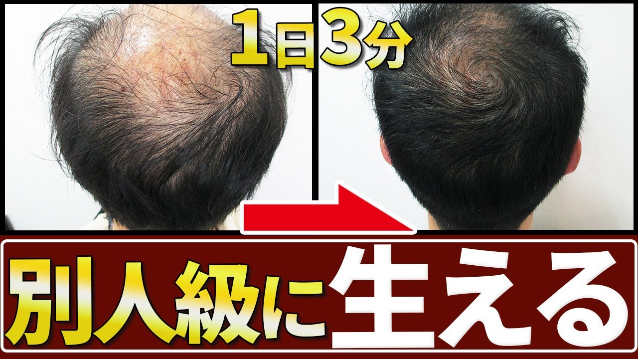 Only 3 Minutes] Scalp Massage for Thinning Hair Prevention You Can