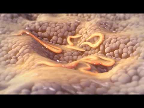 Video: Differenza Tra Colonscopia E Sigmoidoscopia