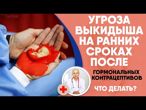 Риск угрозы выкидыша на раннем сроке из за гормональной контрацепции. Что делать?