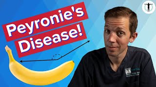 Does Your Penis CURVE?? | Treating Peyronie's Disease!