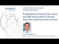 Embolization of Internal Iliac artery &amp; VBX stent graft for Common Iliac artery Aneurysm &amp; occlusion