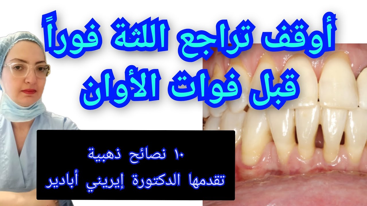 علاج انحسار و تراجع اللثة بالمنزل بنصائح ذهبية و حلول للحالات المتقدمة  Récession gingivale 