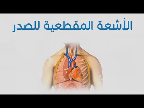 فيديو: غرفة اجتماعات البابا رأس الأفعى