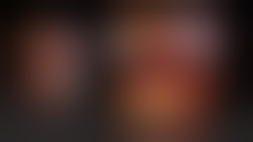 Robotic Excision GIST