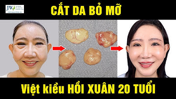 Bác sĩ JW trầm trồ TRẺ HÓA MẮT Midface 3 in 1, Treo chân mày Việt kiều U60 HỒI XUÂN 20 TUỔI