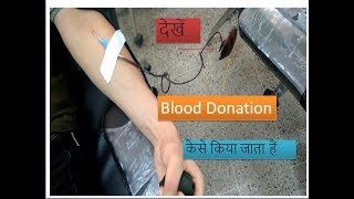 Phlebotomy skills|| fresh blood collection for blood bank
