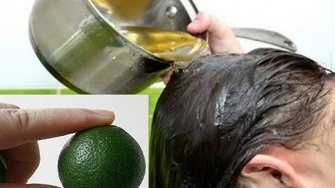 Rụng Tóc Hói Đầu 10 người dùng thì 9 người bất ngờ về phương  pháp này