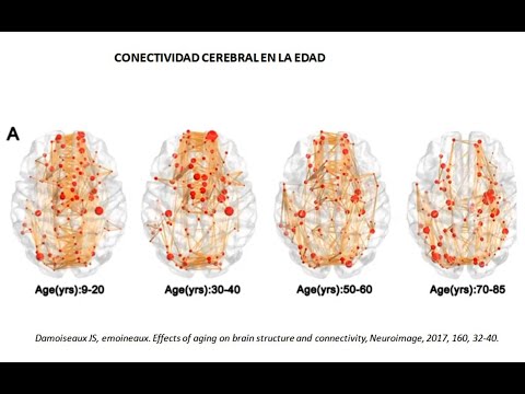 Ancianos sin interacción social afecta su cerebro