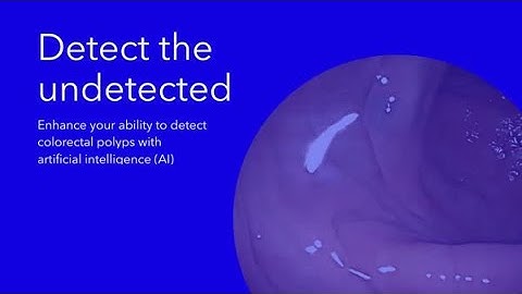 Detect the Undetected with GI Genius™ Intelligent endoscopy module
