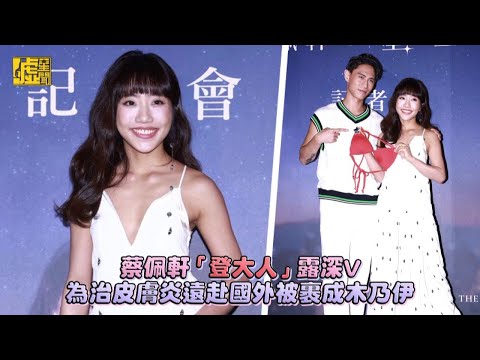 蔡佩軒「登大人」露深V 為治皮膚炎遠赴國外被裹成木乃伊