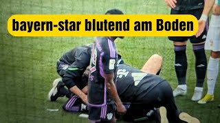 VfB Stuttgart gegen den FC Bayern München bayernstar bluten am Boden !! #fcbayern #vfbstuttgart