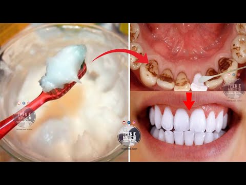 Video: 3 mënyra për të zbardhur dhëmbët me metoda natyrale