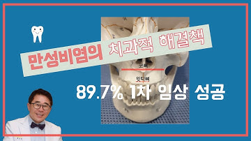 일생동안 달고 사는 만성비염, 임상 성공률 89.7%가 입증하는 치과적 해결책