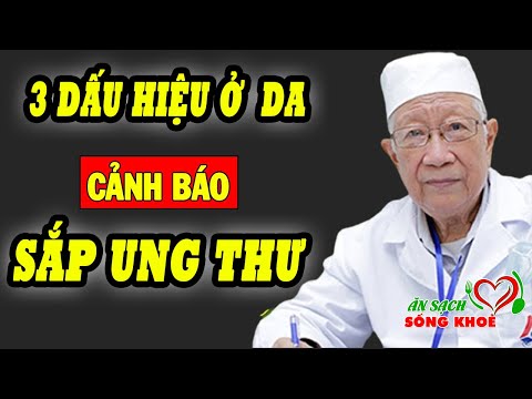 Video: Các Bác Sĩ Khuyên Uspenskaya Nên Bỏng Da ở Cổ Do Những Thay đổi Liên Quan đến Tuổi Tác