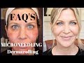 Microneedling | Dermarolling Q&A | Before, During and After Pics