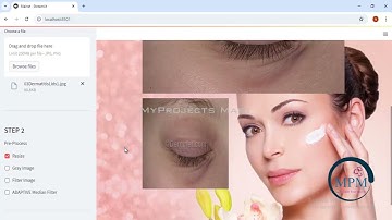 IEEE Final Year Project | Skin Disease Prediction | Machine Learning| streamlit Web App - Python