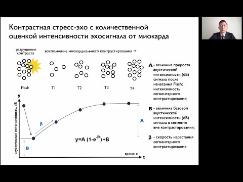 Возможности количественной перфузионной ЭхоКГ в оценке нарушений коронарного кровоснабжения