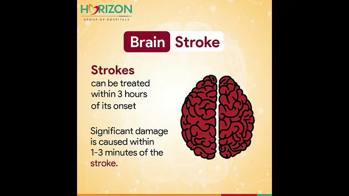 Brain stroke treatment | Patient review | Horizon Hospital