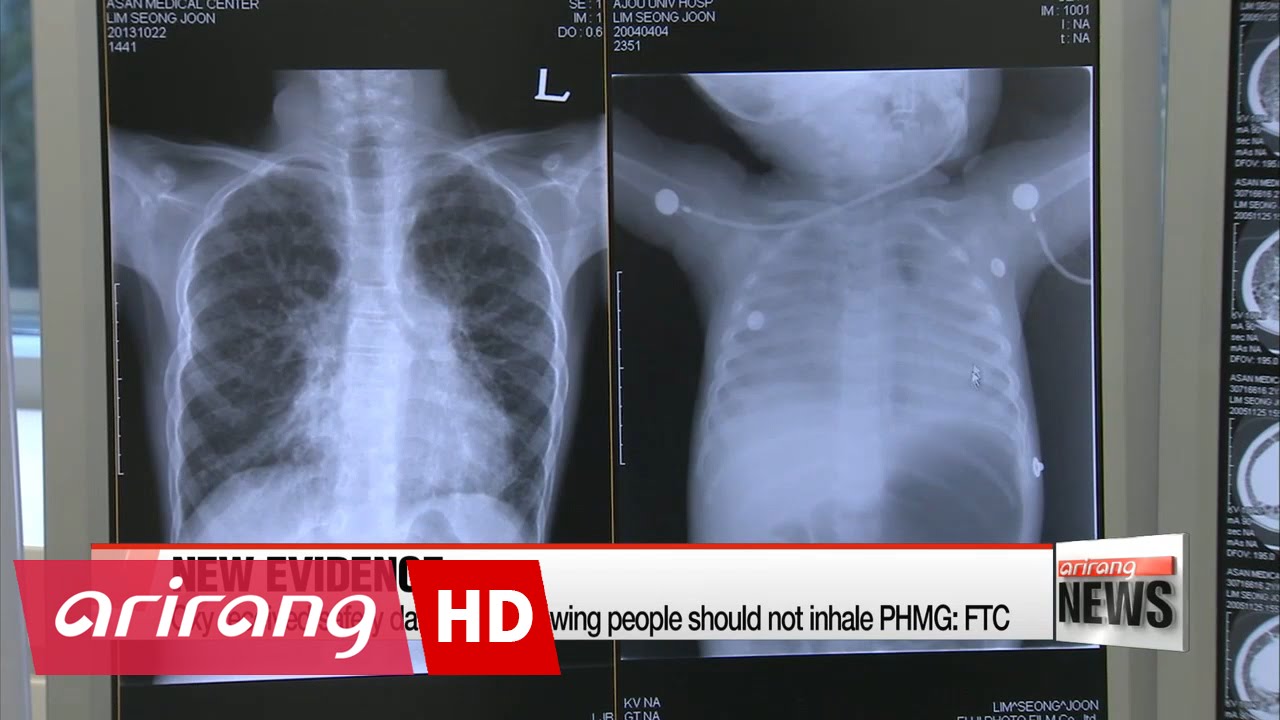 FTC data indicates Oxy knew of sterilizers' potential dangers YouTube