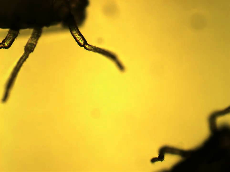 Aphids under a microscope