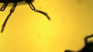 Aphids under a microscope