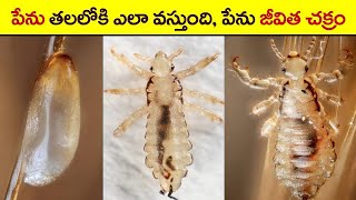 🔵 పేను ఎలా పుడుతుంది? | lice life cycle in detail | Life cycle of lice? How do you get head lice?