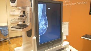 When Should You Get a Mammogram? Depends Whom You Ask - Newsy