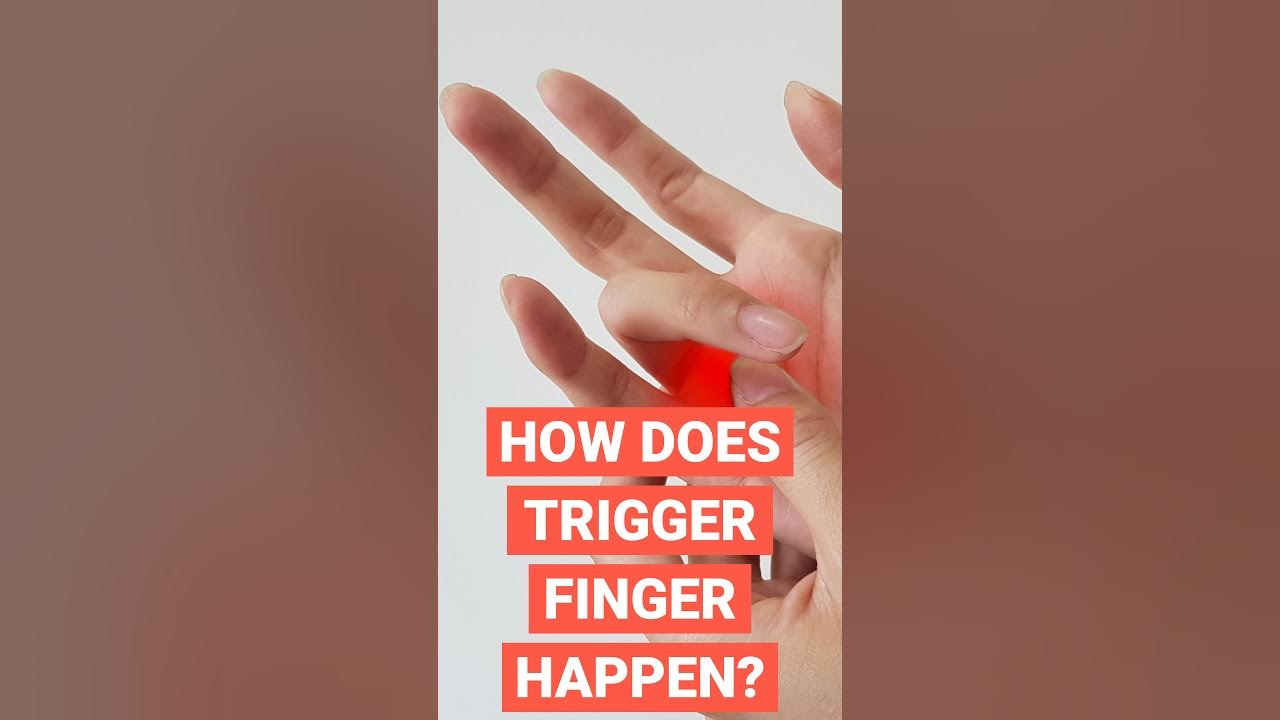 How Does Trigger Finger Happen? shorts short shortvideo YouTube
