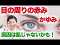 アトピー?肌荒れ? 目の周りの赤みの意外な原因と対策・解消法