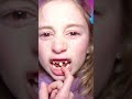 Giorgia ha paura di staccarsi il dente da sola e Papà Salvo l&#39;aiuta! #salvoegiorgia #shorts