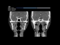 Imagenología de Cuello para Anatomía