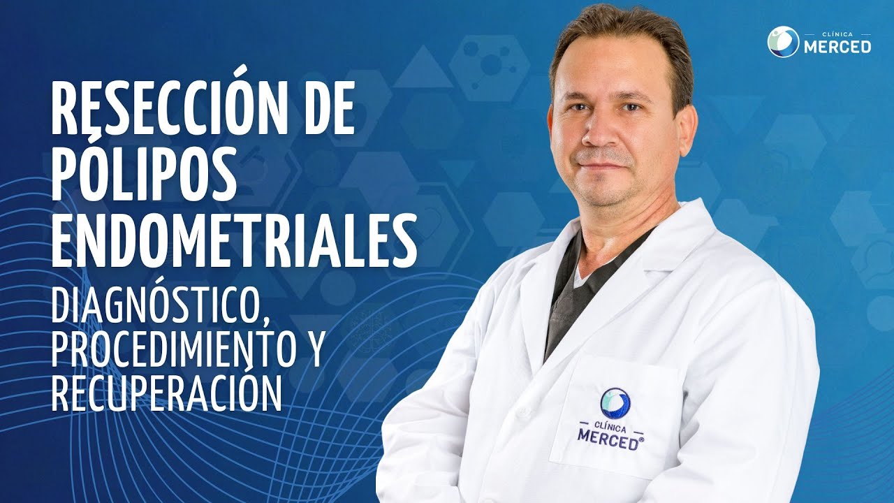 Resección de Pólipos Endometriales: Diagnóstico, Procedimiento y Recuperación