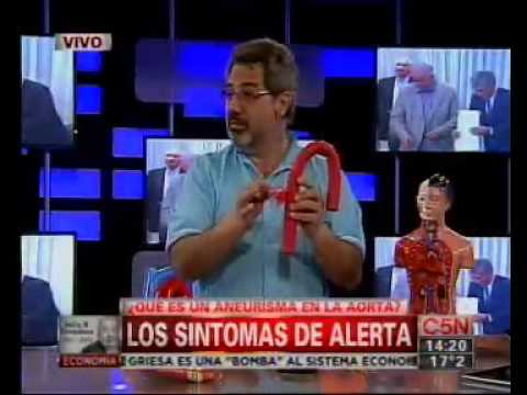 Aneurisma que es sintomas