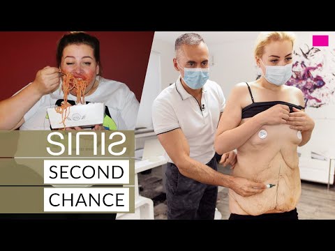 SINIS SECOND CHANCE: Ein neuer Körper für DSDS-Star Aline Bachmann
