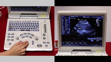 Mindray Z6: How to review images on the Z6 - video 8