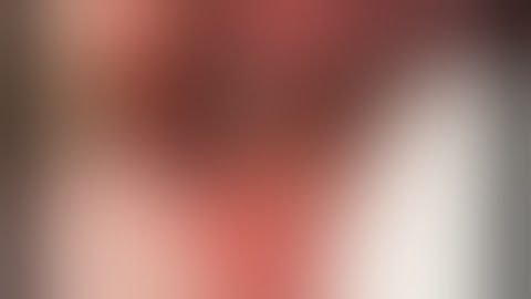 Peizo Surgery DTE Alveolar ridge expansion